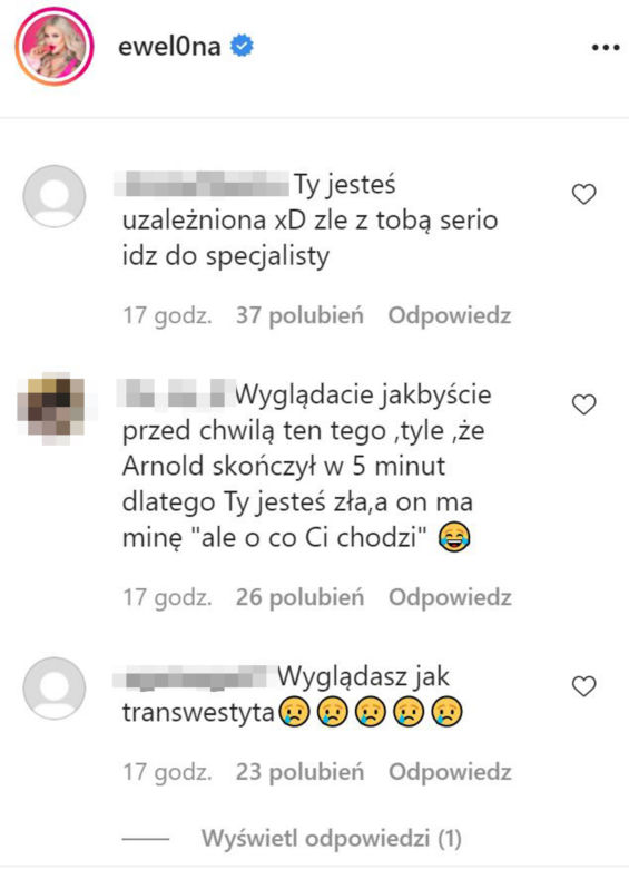 Ewelina z Warsaw Shore przesadziła z operacjami