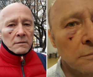  Krzysztof Pieczyński został pobity