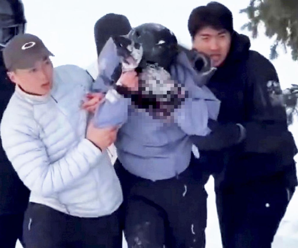 Horror na stoku. Narciarce krew się lała z twarzy. Zaatakował ją drapieżnik!