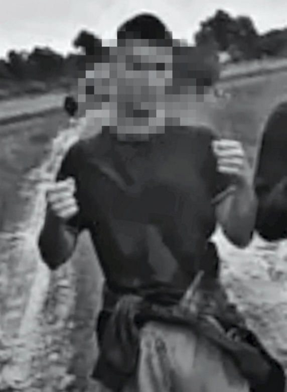 Koszmar w Jaworznie. 17-latek oblany benzyną i podpalony przez kolegów