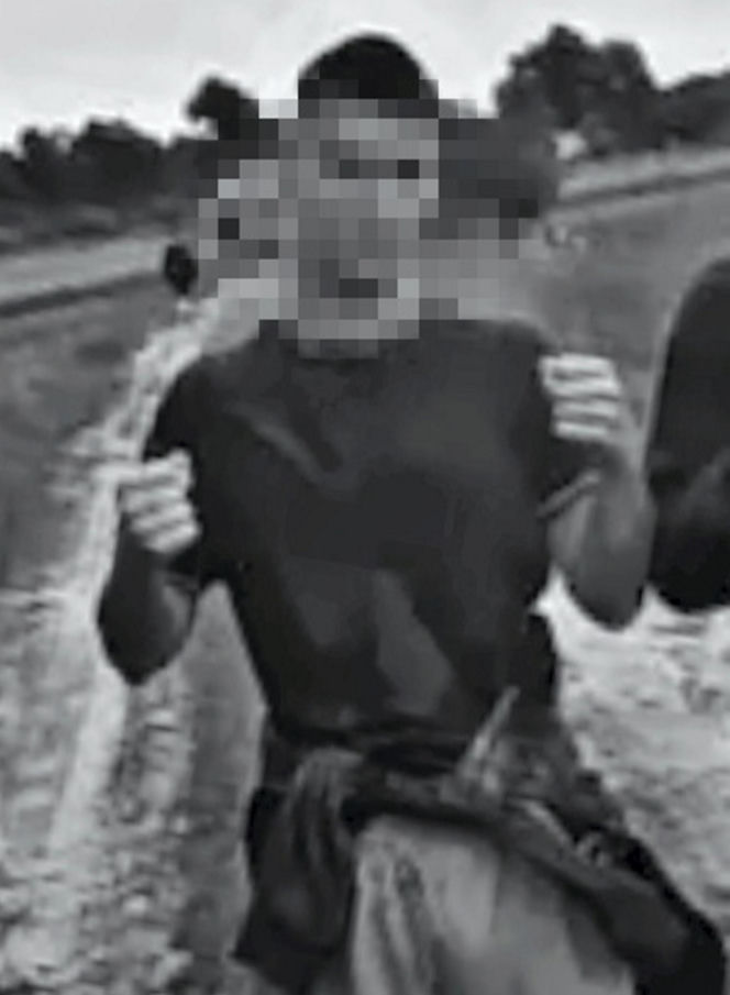 Koszmar w Jaworznie. 17-latek oblany benzyną i podpalony przez kolegów
