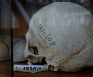 Muzeum Zakładu Medycyny Sądowej w Krakowie. Tu przechowuje się narzędzia głośnych zbrodni [ZDJĘCIA]