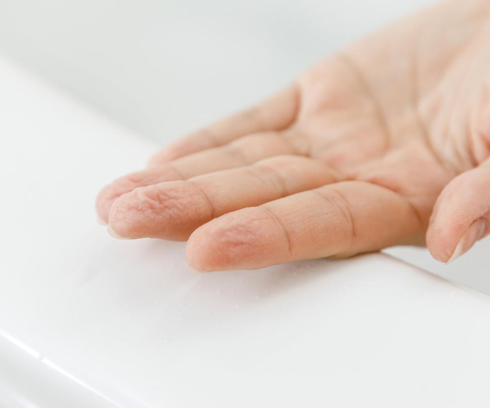 Dłoń z pomarszczonymi palcami po kąpieli, opartymi o białą, mokrą powierzchnię, z widocznymi kroplami wody. Brak tego zjawiska może wskazywać na ukrytą chorobę, o czym przeczytasz więcej na portalu Poradnik Zdrowie.