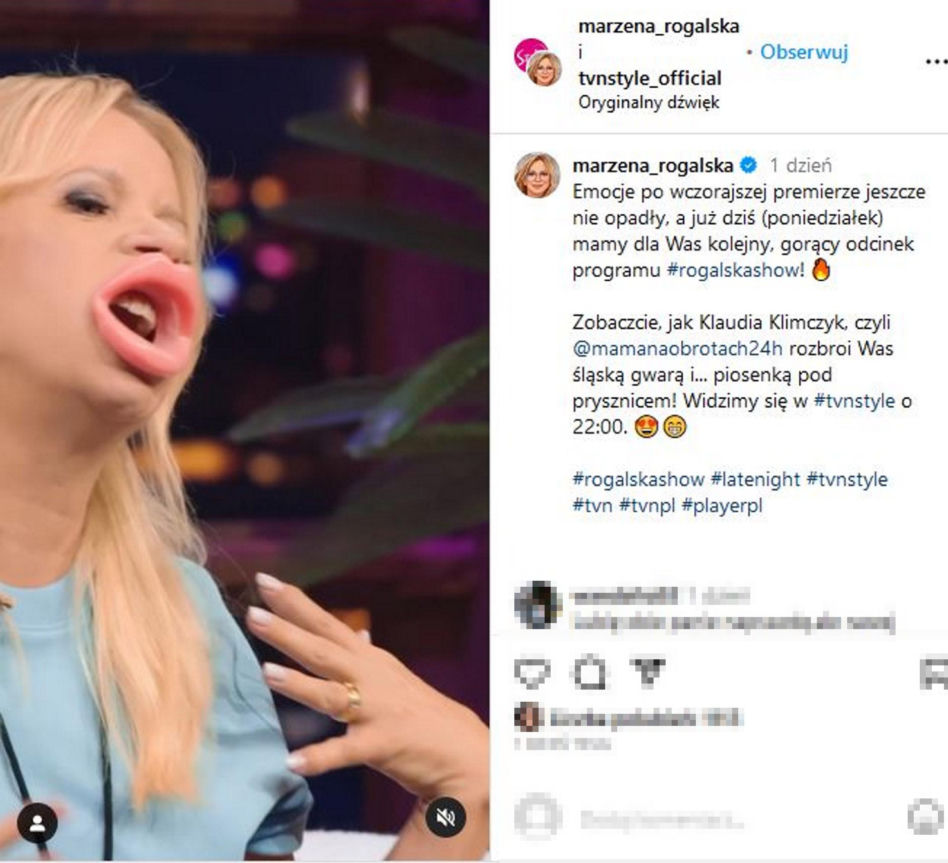 Ogromne usta Marzeny Rogalskiej! Co ona z sobą zrobiła?!