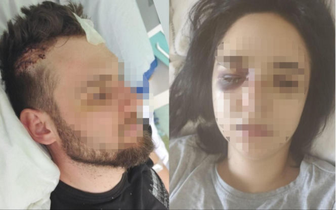 Paweł W. mógł zabić młode małżeństwo przygniatając ich samochodem do ściany