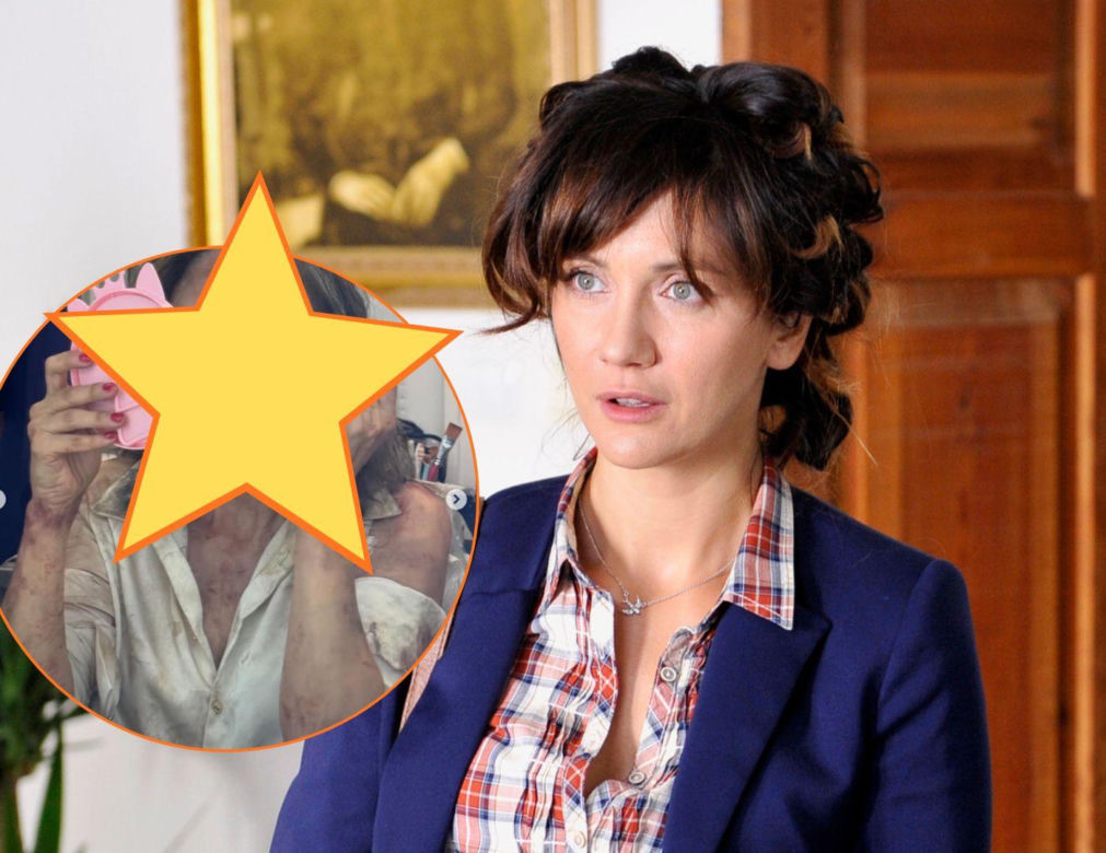 Ranczo. Lucy (Ilona Ostrowska) zginie w nowym sezonie?! Obrażenia aktorki wyglądają przerażająco