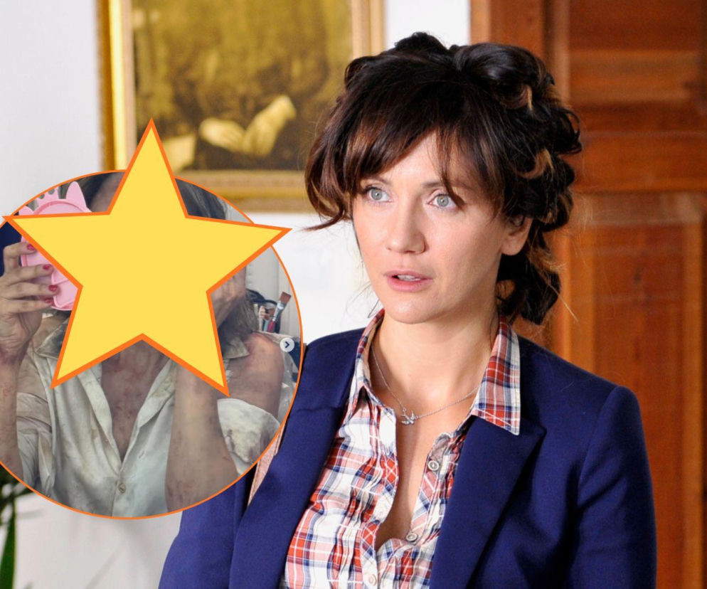 Ranczo. Lucy (Ilona Ostrowska) zginie w nowym sezonie?! Obrażenia aktorki wyglądają przerażająco