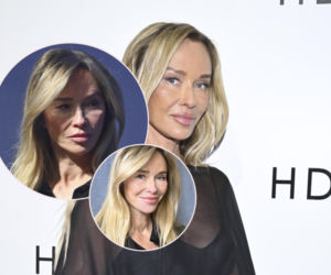 Co Joanna Przetakiewicz zrobiła sobie z twarzą? Jestem spuchnieta