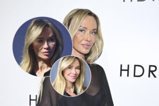 Co Joanna Przetakiewicz zrobiła sobie z twarzą? Jestem spuchnieta