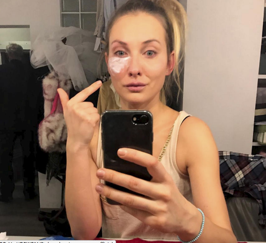 Podbili jej oko u Jandy