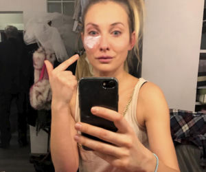 Podbili jej oko u Jandy