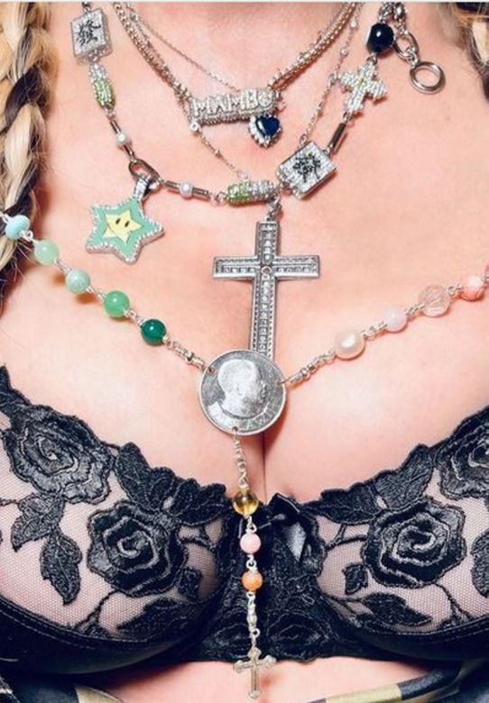Madonna z wielkim siniakiem. Kto jej to zrobił?