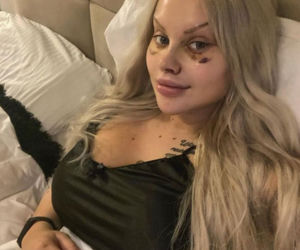 Ewelina z Warsaw Shore przesadziła z operacjami