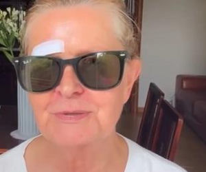 Barbara Busztynowicz miała wypadek! Skończyło się szyciem. Nikt się nie zatrzymał