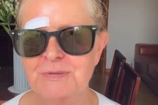 Barbara Busztynowicz miała wypadek! Skończyło się szyciem. Nikt się nie zatrzymał