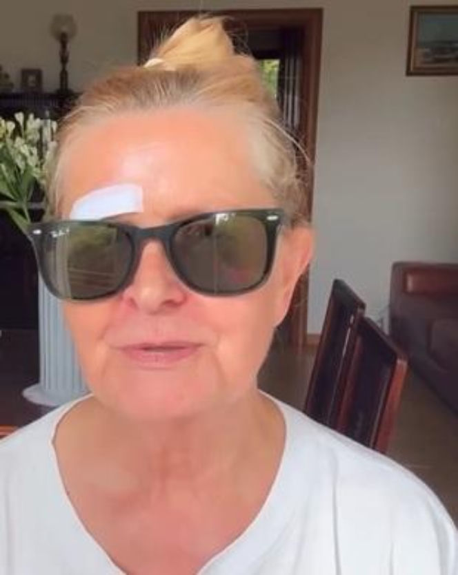 Barbara Busztynowicz miała wypadek! Skończyło się szyciem. "Nikt się nie zatrzymał"