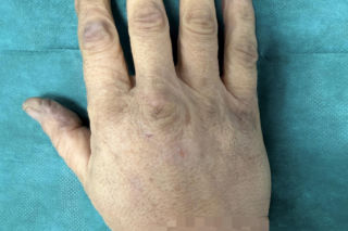 Wojciech Różycki stracił dłoń