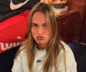 Aryna Sabalenka i jej twarz z bliska