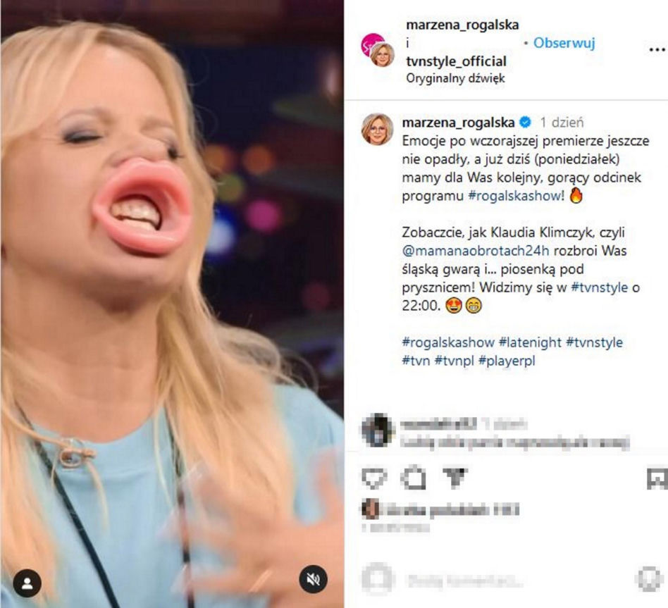 Ogromne usta Marzeny Rogalskiej! Co ona z sobą zrobiła?!
