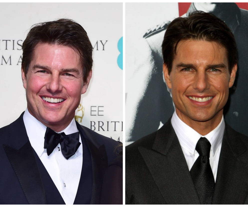 Tom Cruise zrobił botoks?