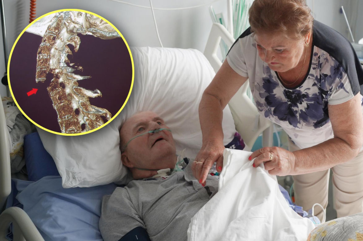 "Urwało mi głowę ale już mi lepiej"
