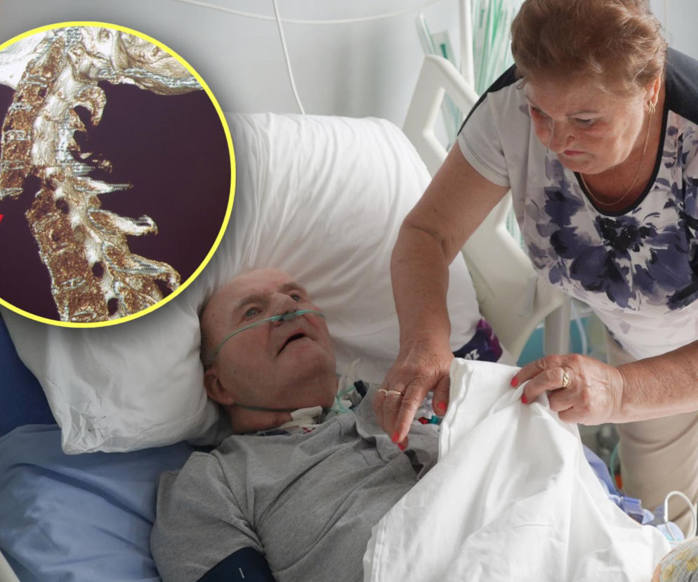 Pan Henryk cudem przeżył wypadek na działce. Urwało mi głowę!