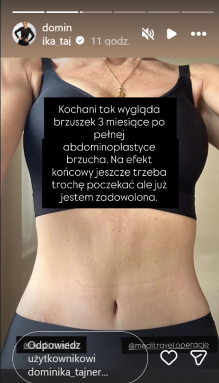 Dominika Tajner