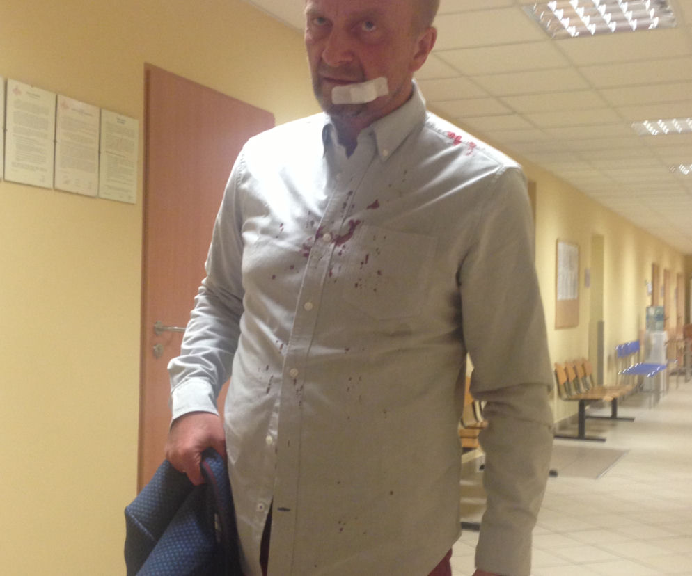 Arkadiusz Nader, policjant z Rancza pobity przez żonę Wioletkę?!