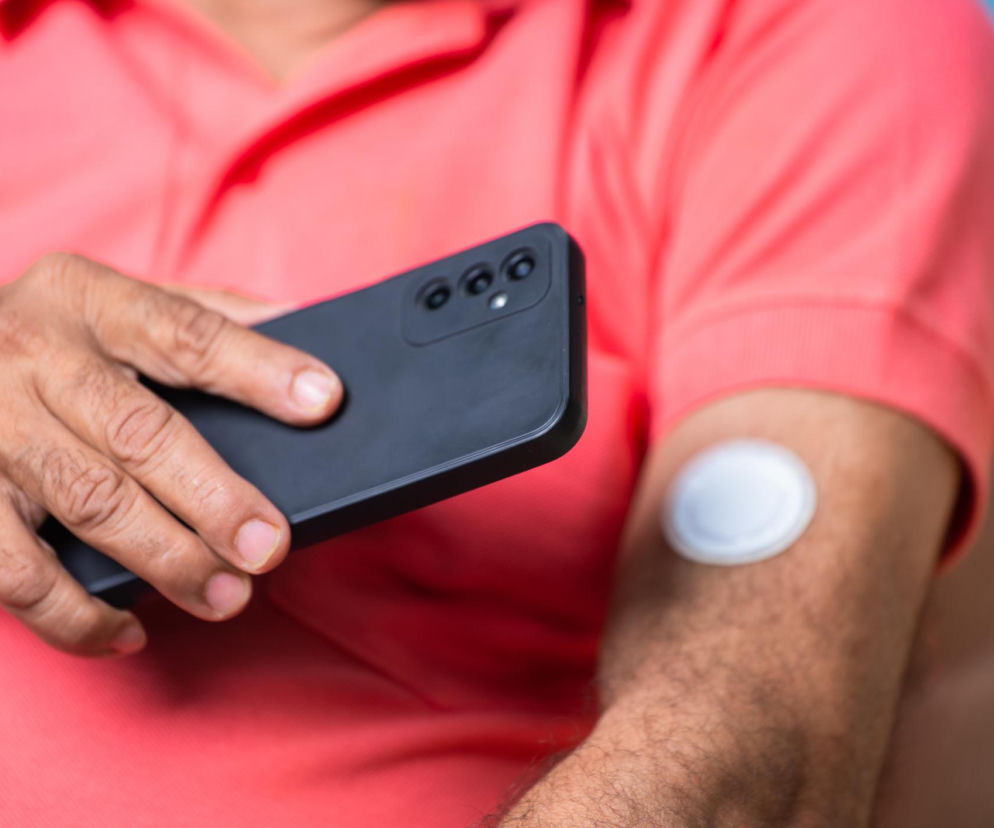 Mężczyzna w różowej koszulce trzyma smartfon, skanując sensor ciągłego monitorowania glukozy (CGM) przymocowany do ramienia. To narzędzie diagnostyczne jest istotne w terapii cukrzycy, o której można przeczytać na portalu Poradnik Zdrowie.