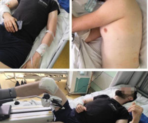 Paweł W. mógł zabić młode małżeństwo przygniatając ich samochodem do ściany