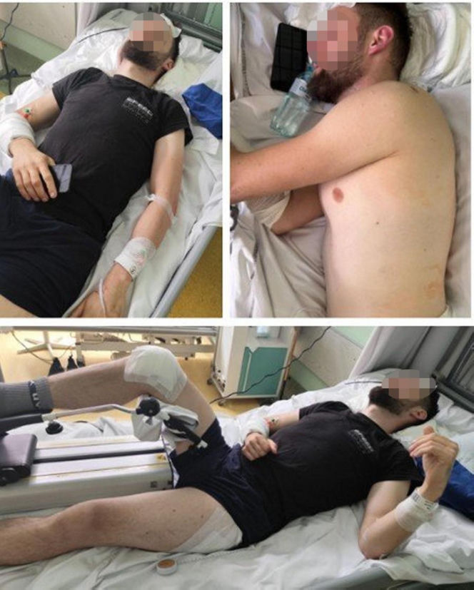 Paweł W. mógł zabić młode małżeństwo przygniatając ich samochodem do ściany