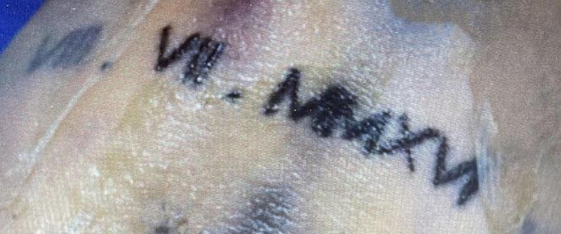 26-letnia Daria nie żyje. Ciało znaleziono w lesie 