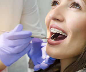 Wyleczyła setki nieistniejących zębów. Dentystka wyłudziła fortunę z NFZ