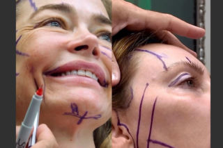 Denise Richards i jej lifting twarzy szokują. Aktorka się tłumaczy i pokazuje nagranie z zabiegu