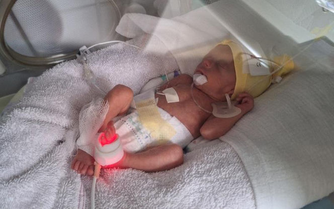 Dzień Wcześniaka w Szpitalu św. Zofii w Warszawie