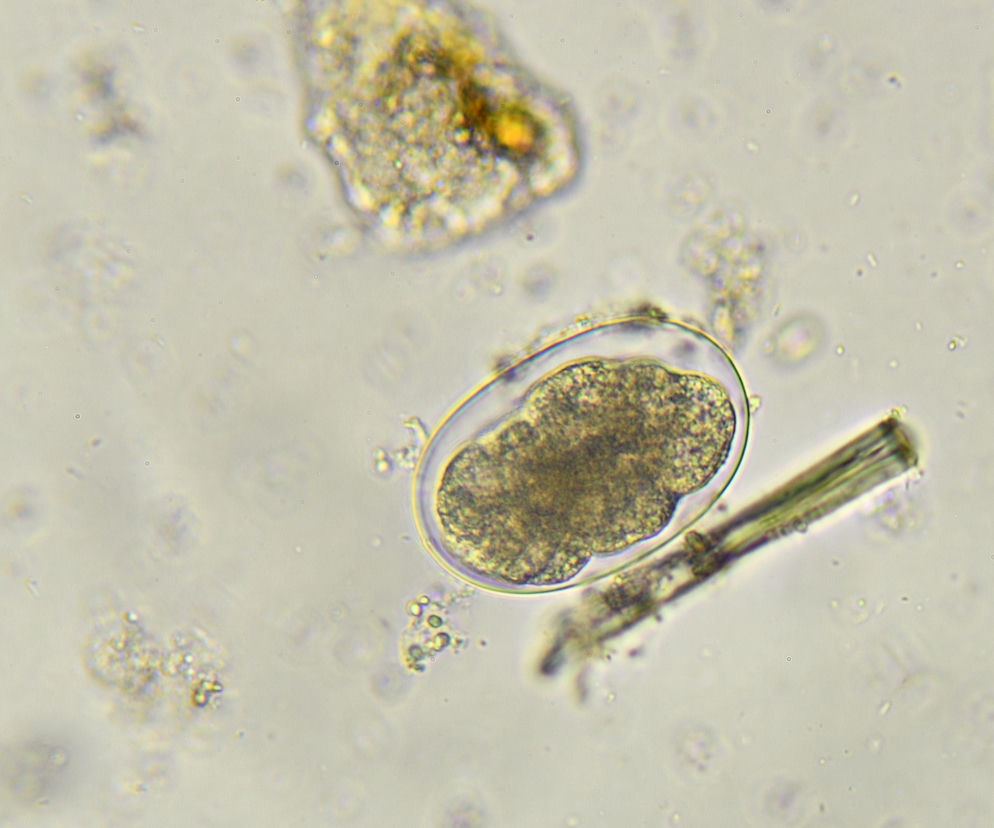 Jajo tasiemca Echinococcus multilocularis widoczne pod mikroskopem, otoczone przez komórki, na jasnym tle. Jajo o owalnym kształcie, z ciemniejszym wnętrzem, podkreśla zagrożenie opisane na Poradnik Zdrowie.