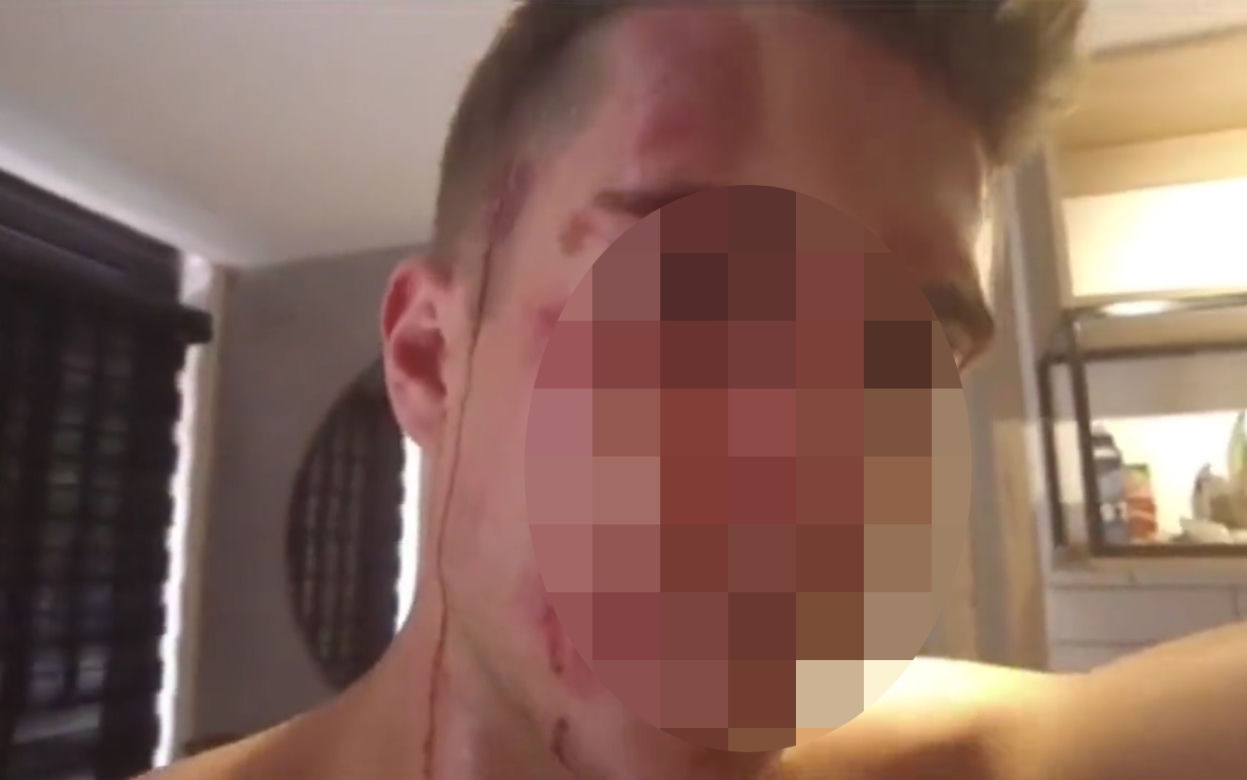 Polała się krew! „Mieliśmy przyłożone do ciała noże”