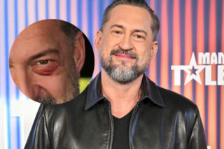 Marcin Prokop po rozstaniu pokazał podbite oko i rzucił niewybredny żart. Teraz powiedział, co naprawdę się stało