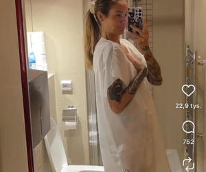 Karolina Gilon zoperowała biust. Zdjęcia przed i po