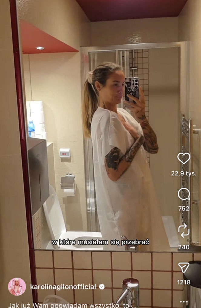 Karolina Gilon zoperowała biust. Zdjęcia przed i po