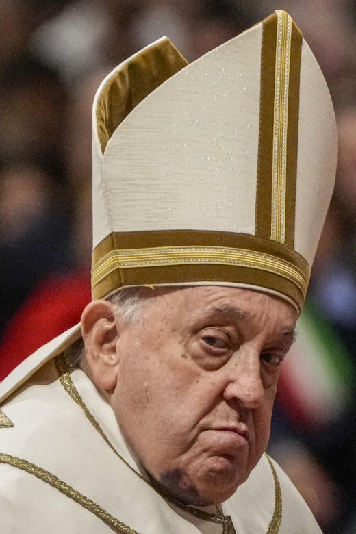  Papież Franciszek z siniakami na twarzy! Co się stało?