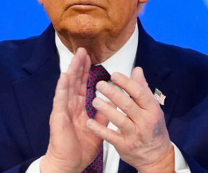 Tajemniczy znak na ręce Trumpa! Rzeczniczka tłumaczy