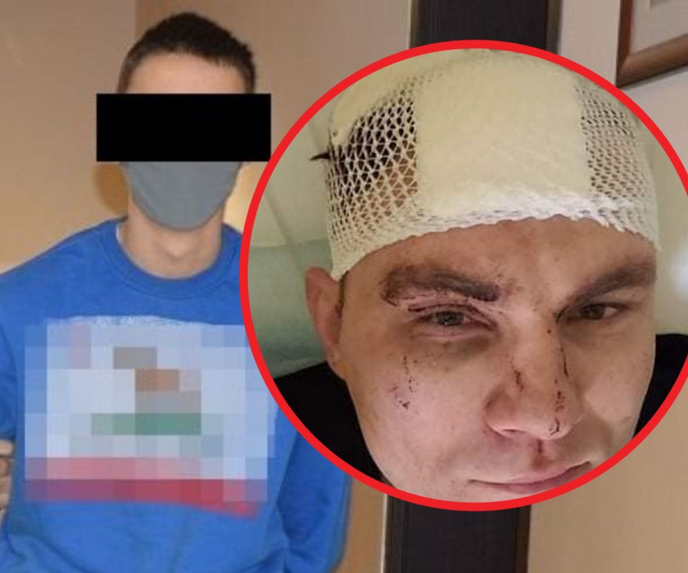 Znany muzyk skatowany siekierką! Chciał powstrzymać bandytów [ZDJĘCIA]