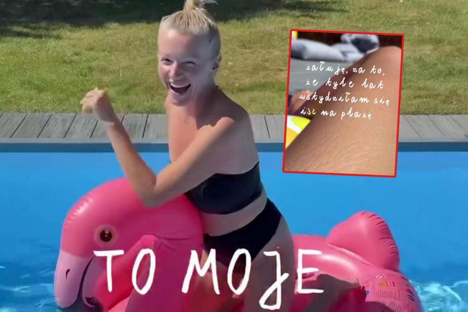 Dorota Szelągowska nie wstydzi się rozstępów