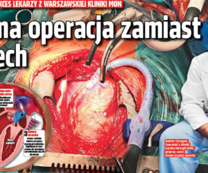 Jedna operacja zamiast trzech