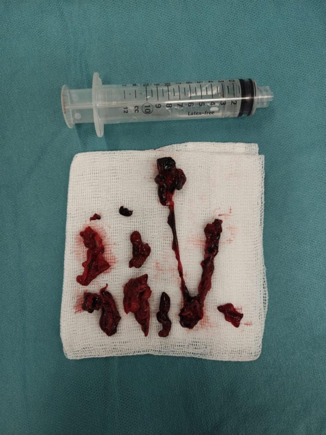 "Pazurami wyrywaliśmy ją śmierci". Lekarze z Białegostoku cudem uratowali 36-letnią Justynę