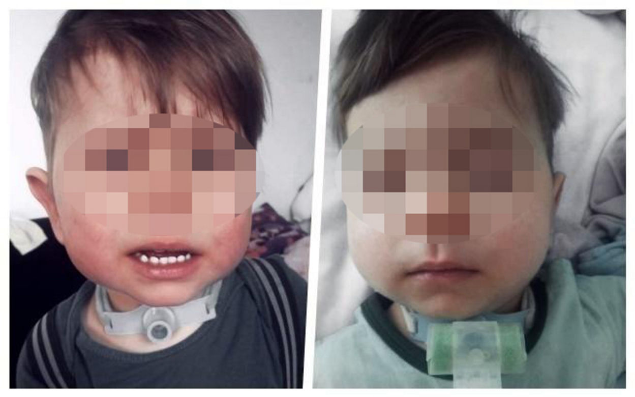 Mały Wiktorek pilnie potrzebuje ratunku! Trzeba mu pomóc całym sercem, bo ma tylko pół serduszka [ZDJĘCIA].