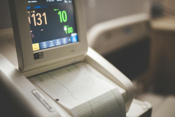 Serce traci rytm i zagraża sprawności mózgu. Nowe wytyczne kardiologiczne chronią przed udarem 
