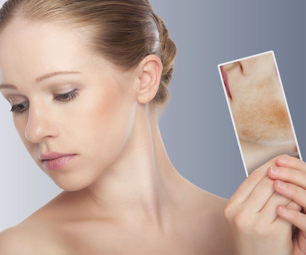 Psychodermatologia - wsparcie psychologiczne dla osób z chorobami skóry