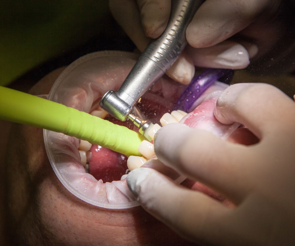 Lublin. Dentysta oskarżony o zmuszenie pacjentki do seksu oralnego. Nie była jedyną ofiarą?